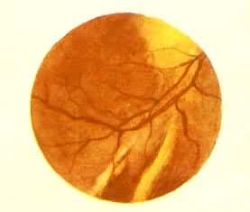 ����ͷ����