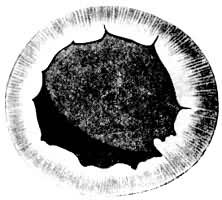 ������ͫ��Ե���Ѻ;�״�����λ