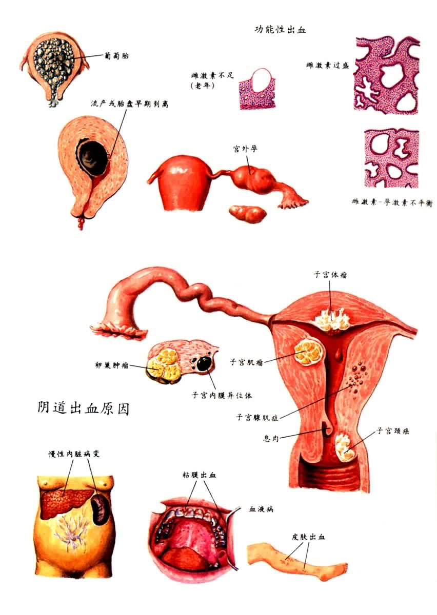 ������Ѫ����