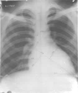 �˶�Ա����ģ�����Ӱ�����ԣ������꣬��·���г��˶�Ա����������󣵣�����