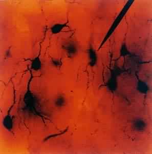 ��΢�缫��¼��ϸ�������ĳ嶯