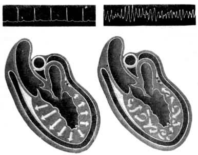 ͼ2���������������ұ�ɻ���״̬��������ά����